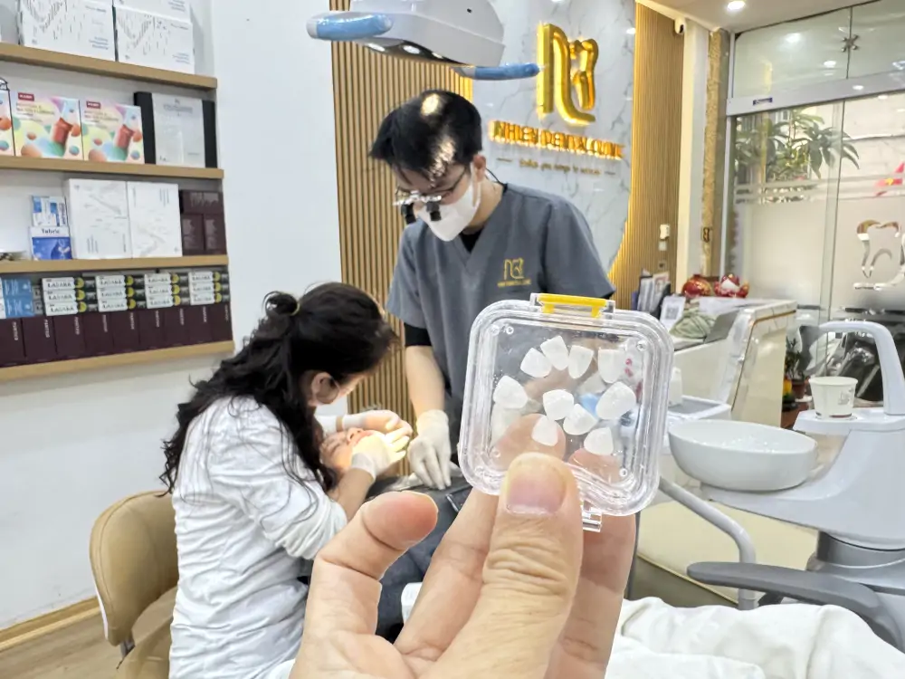 Răng sứ Lava Plus - Mỹ