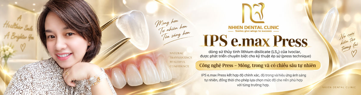 veneer nha khoa nhien 2.jpg