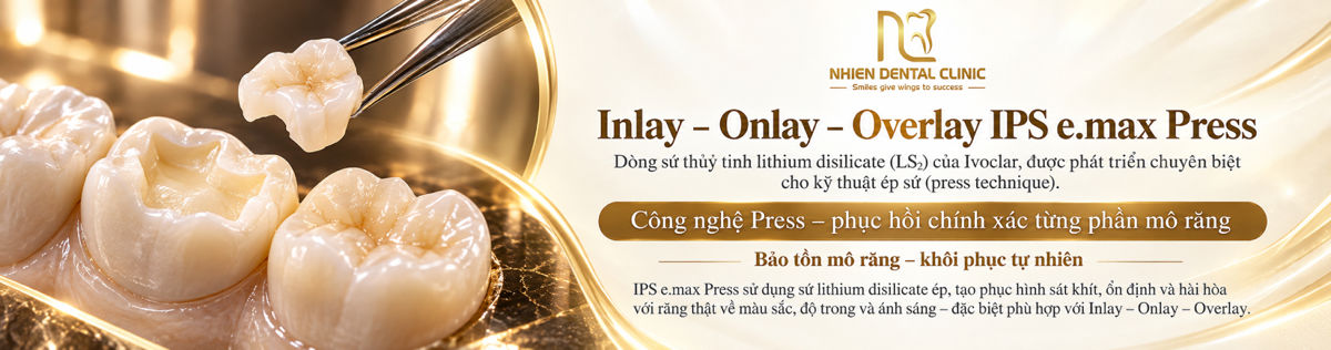 inlay - onlay - nha khoa nhien 2.jpg