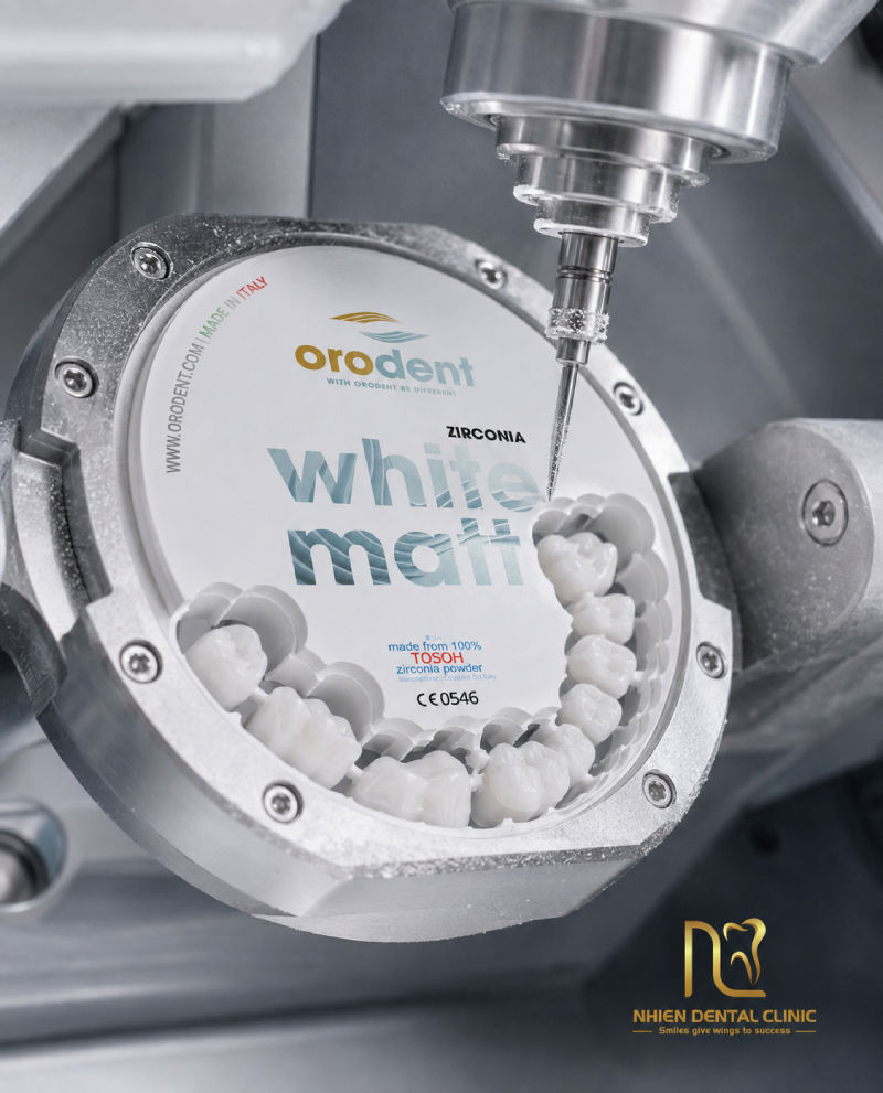nha khoa nhien - orodent white matt 1.jpg