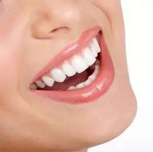Răng sứ Ceramill - Đức