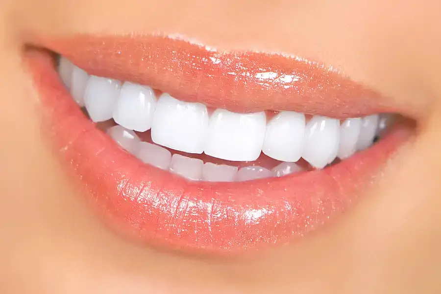 Răng sứ Lava Plus - Mỹ