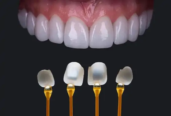 Dán venner emax - Đức