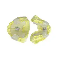 Khí cụ chức năng Twin Block